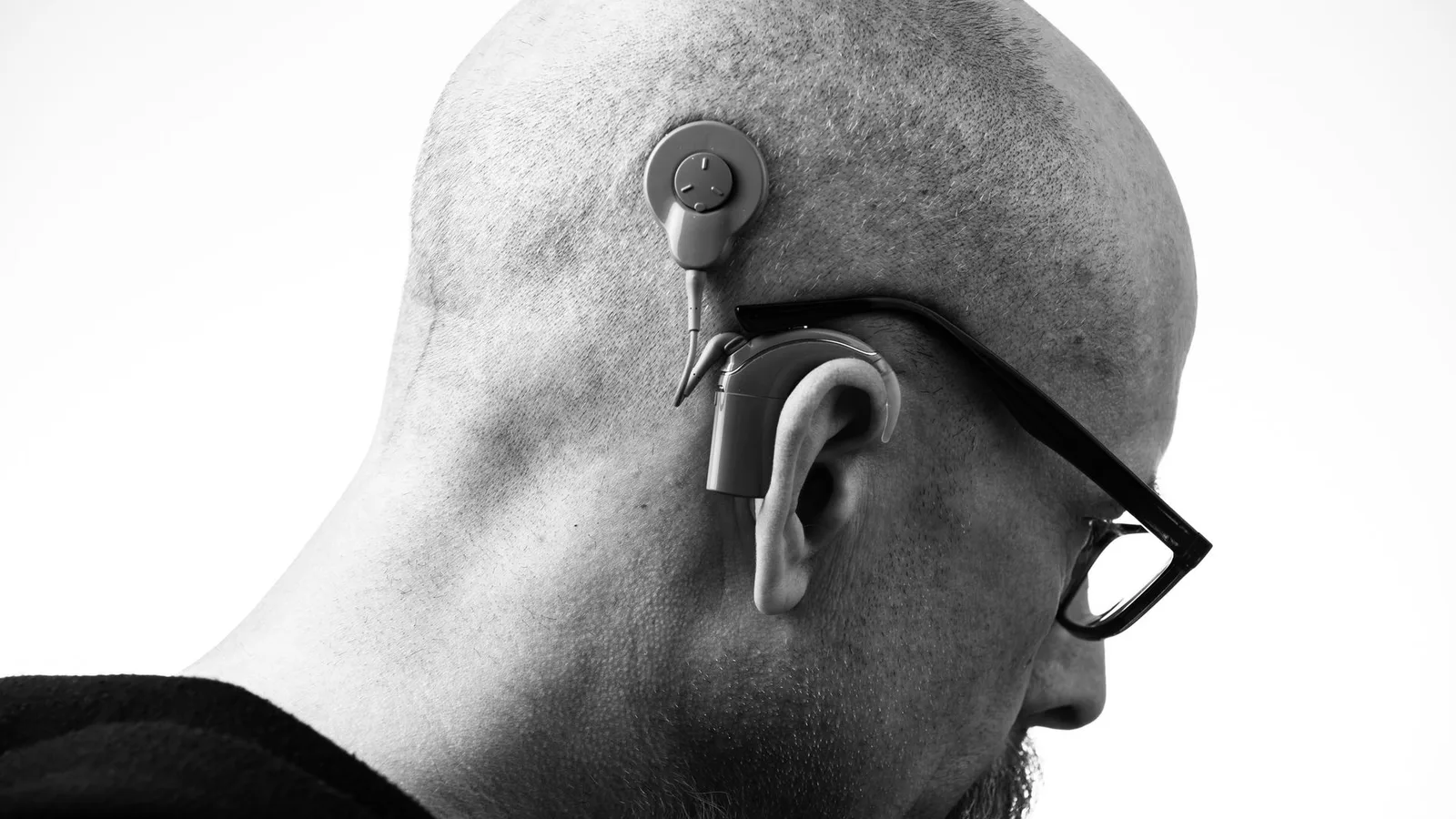Pessoa segurando um aparelho auditivo usado com expressão de dúvida