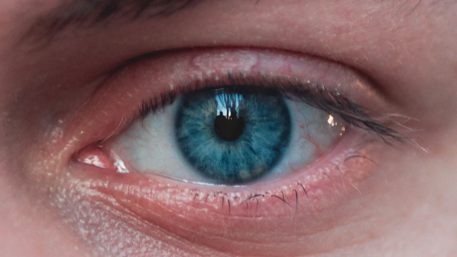 Mulher com coceira nos olhos ao usar lente de contato