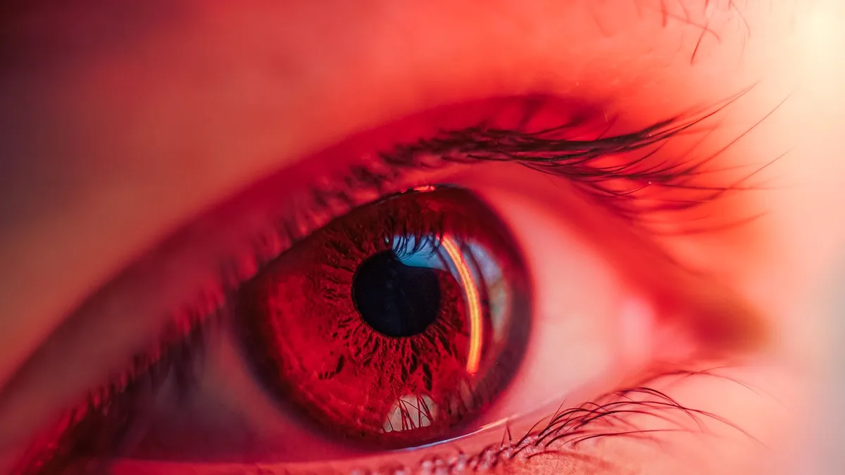 Close de olho vermelho e irritado