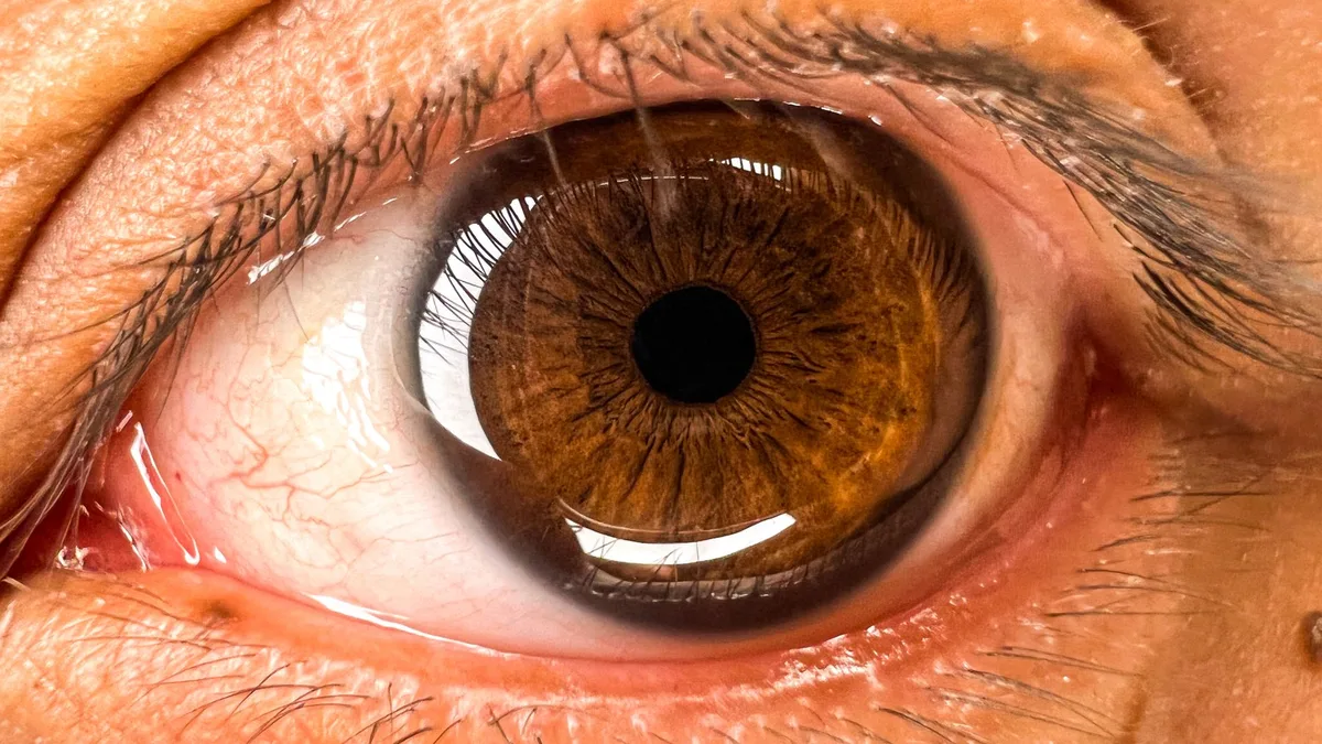 Optometrista realizando adaptação de lentes tóricas com paciente